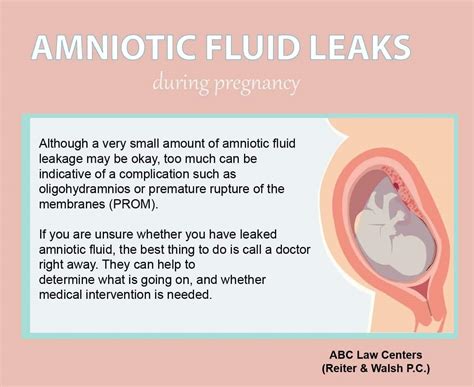 can amniotic fluid leak and then stop|Leaking Amniotic Fluid: Signs, Causes, and。